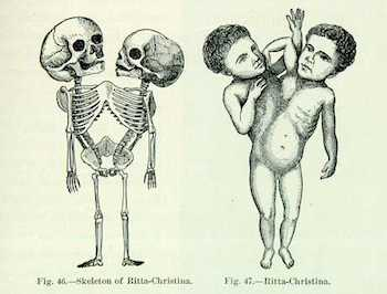 Illustration for article titled A Short, Freakish History of Mothers Harming Their Children For Money